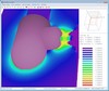 3D electrostatics and high voltage